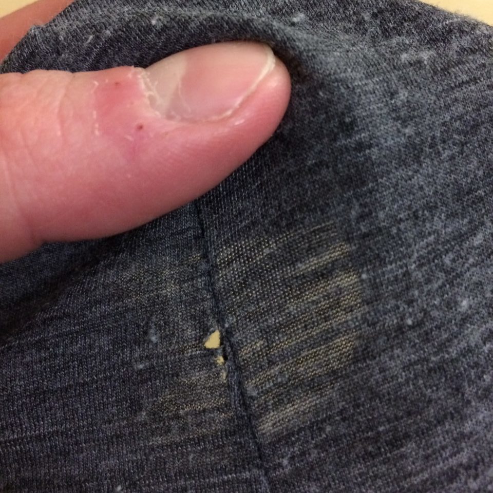 Pill removal fabric damage